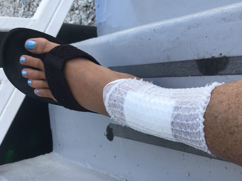 Lanced and wrapped up