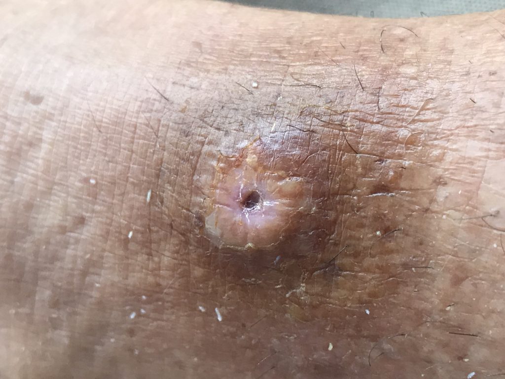After 7-days of treatment